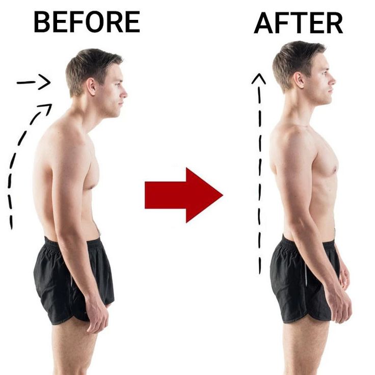 Sports Safety Body Shaper and Posture Corrector